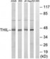 ACAT1 Antibody (aa221-270)